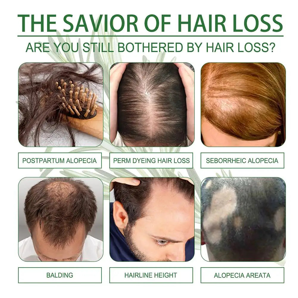 Rosemary & Coconut Hair Growth Oil